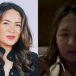 La batalla de Yolanda Andrade: superación y transparencia en el rostro de la lucha contra una enfermedad que cambió todo