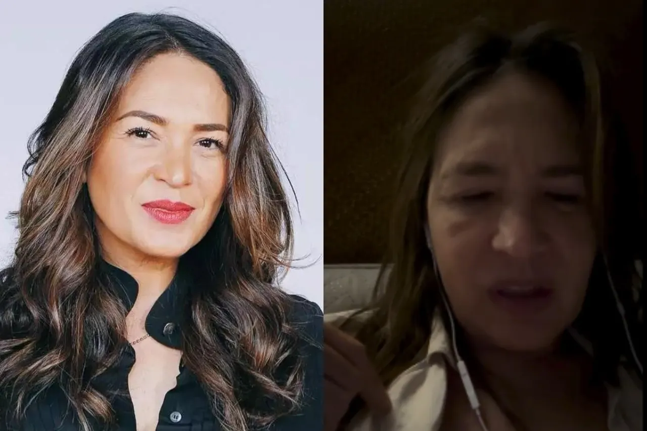 La batalla de Yolanda Andrade: superación y transparencia en el rostro de la lucha contra una enfermedad que cambió todo