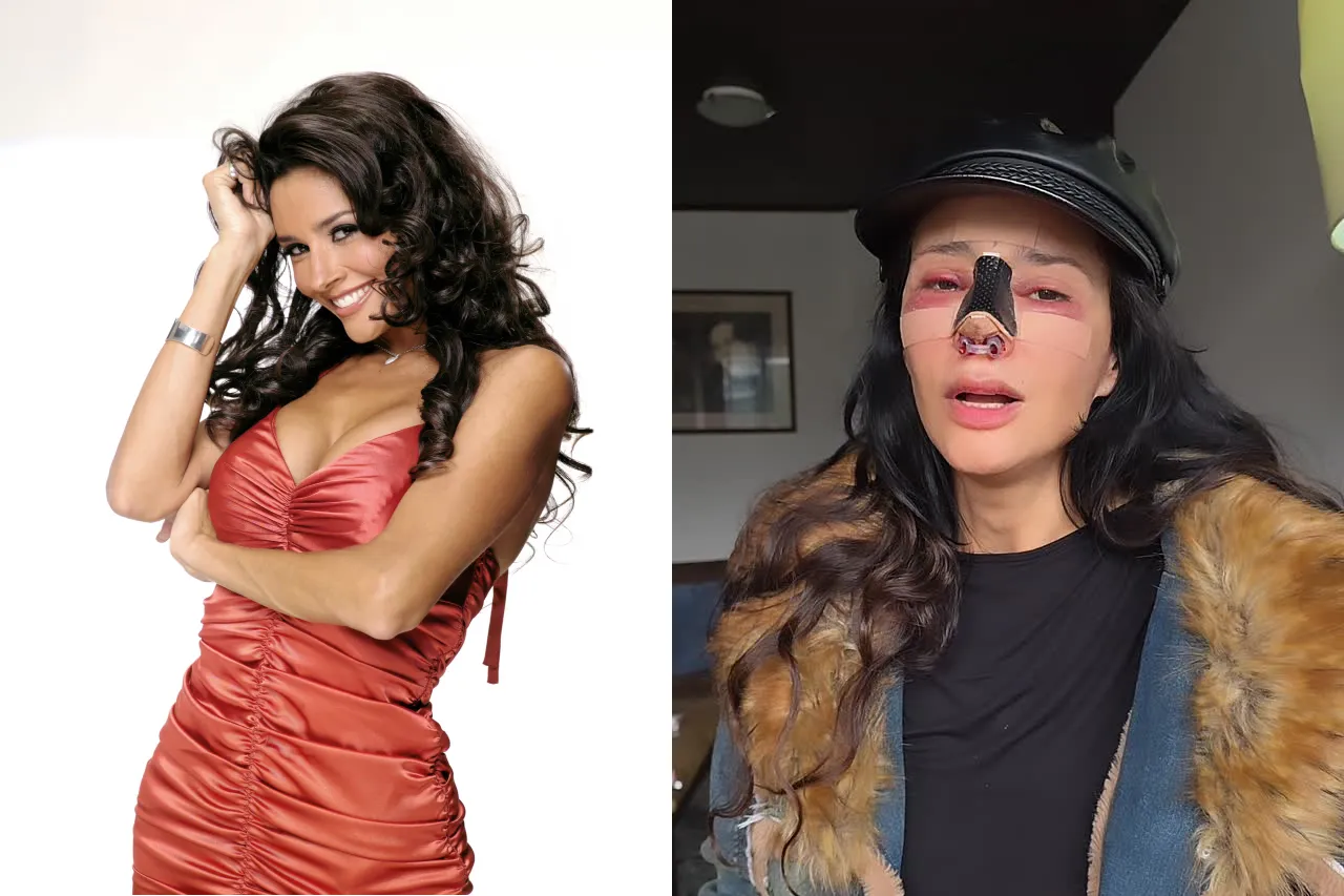 "Cirujanos sin Fronteras: La Investigación Revela una Cultura de la Mala Práctica en Cirugía Estética"