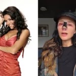 "Tragedia en la Fórmula del Belleza: La Dramática Vida de Dorismar, Una Estrella Caída por un Error Médico"